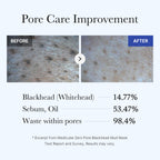 Zero Pore Blackhead Mud Mask